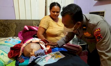 Haru-Pada-Bayi-Penderita-Hidrosefalus,-Kapolda-NTT-Beri-Bantuan