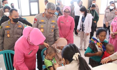 Tahapan-Operasi-Bibir-Sumbing-dalam-rangka-Hari-Bhyangkara-ke-76-Dimulai,-Kapolda-Berharap-Perawatannya-Akan-Berkelanjutan