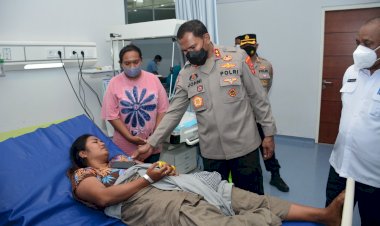 Kapolda-NTT-Tinjau-Korban-Kecelakaan-Kebakaran-KM-Cantika-Express-77-di-Tiga-Rumah-Sakit-Ini