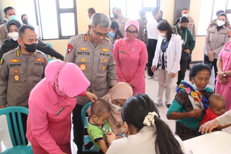 Tahapan Operasi Bibir Sumbing dalam rangka Hari Bhyangkara ke-76 Dimulai, Kapolda Berharap Perawatannya Akan Berkelanjutan