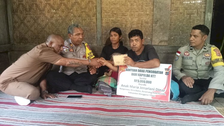 Kapolda NTT Berikan Bantuan Kemanusiaan kepada Balita Penderita Hidrosefalus di Manggarai Timur